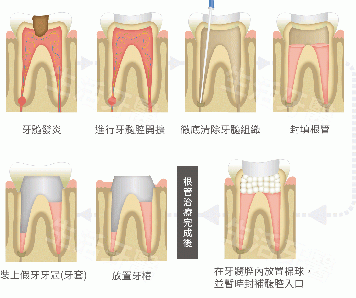 endo.gif