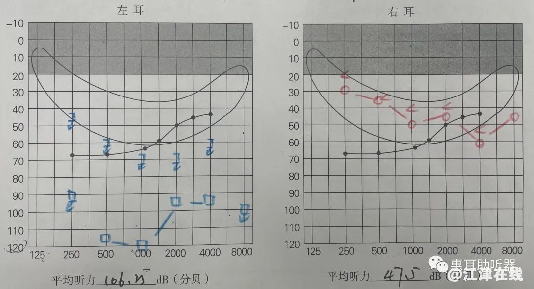 a91e8a68ae2b4d0aaea3d837cadd9c9d~noop.image?_iz=58558&from=article.jpg